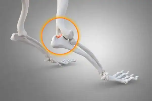 Best Peptides for Osteoarthritis Joint Pain at Pharma Lab Global